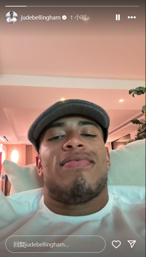 这是什么造型啊贝林晒迷之角度自拍